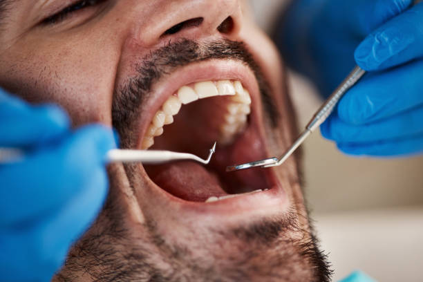 Best Walk-In Emergency Dentist in Nutter Fort, WV